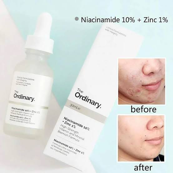 The Ordinary Niacinamide 10% + Zinc 1% Serum – Pores Minimize &amp; Oil Control