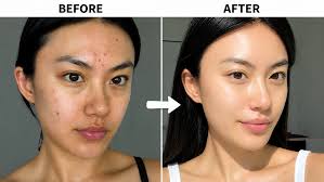 The Ordinary Niacinamide 10% + Zinc 1% Serum – Pores Minimize &amp; Oil Control